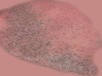 skin1