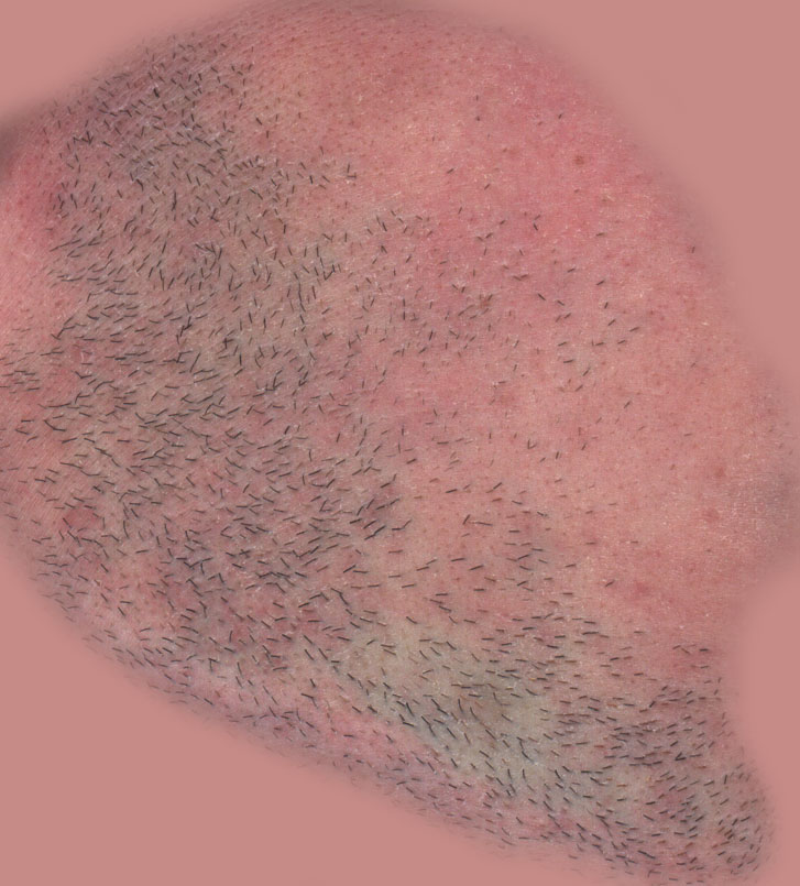 skin1
