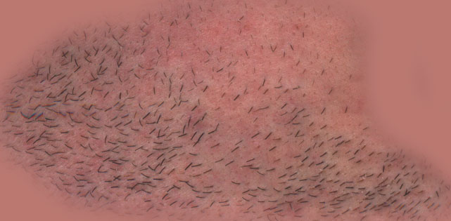 skin2