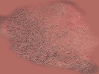 skin4