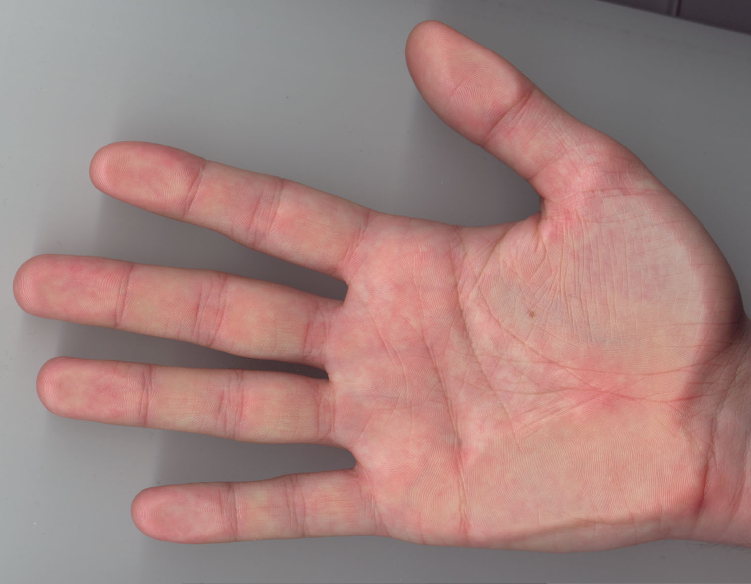 skin5